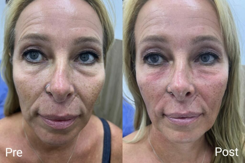 تحسين مظهر تحت العين